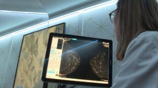 La France Envisage de Réduire l'Âge de Dépistage du Cancer du Sein Face à l'Augmentation des Cas