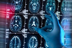 Alzheimer : Le Sommeil Profond, un Bouclier Cérébral Naturel selon une Étude