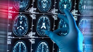 Alzheimer : Le Sommeil Profond, un Bouclier Cérébral Naturel selon une Étude