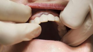 Prothèses dentaires : l'alerte des laboratoires français face à la concurrence chinoise